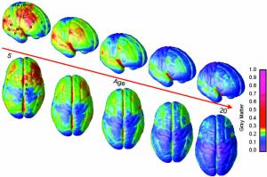 Grey matter changes over time